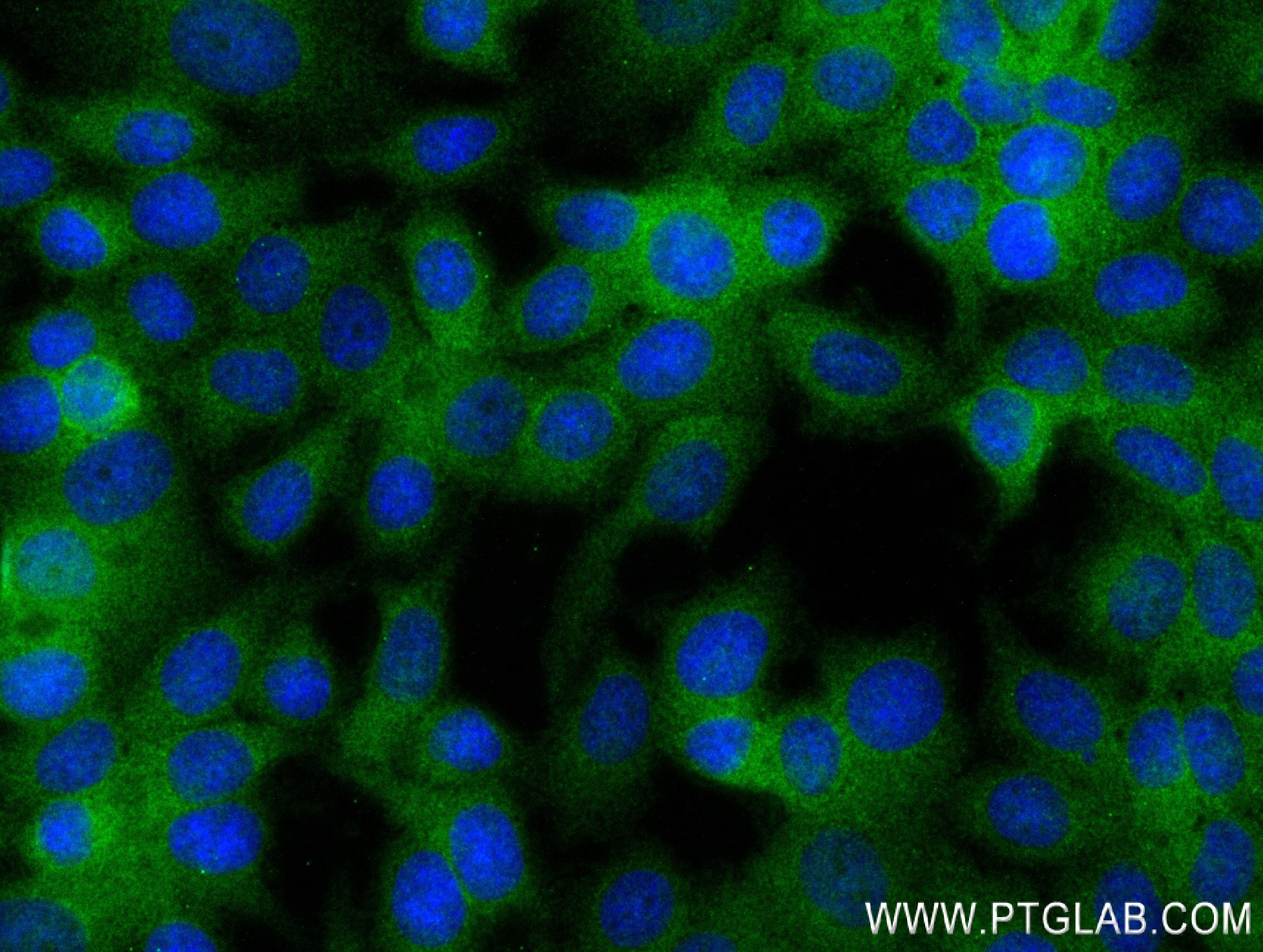 IF Staining of MCF-7 using 84257-1-RR (same clone as 84257-1-PBS)