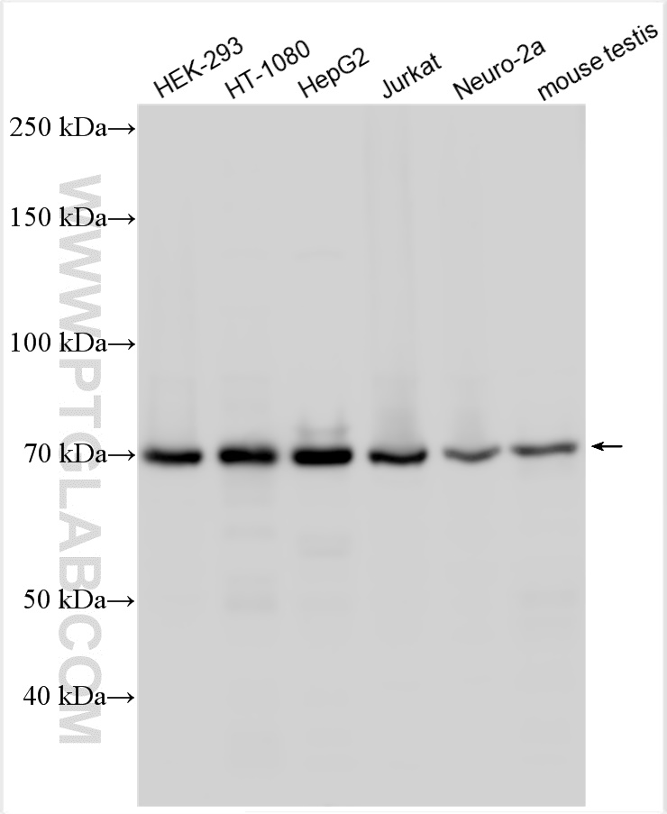 WB analysis using 15073-1-AP