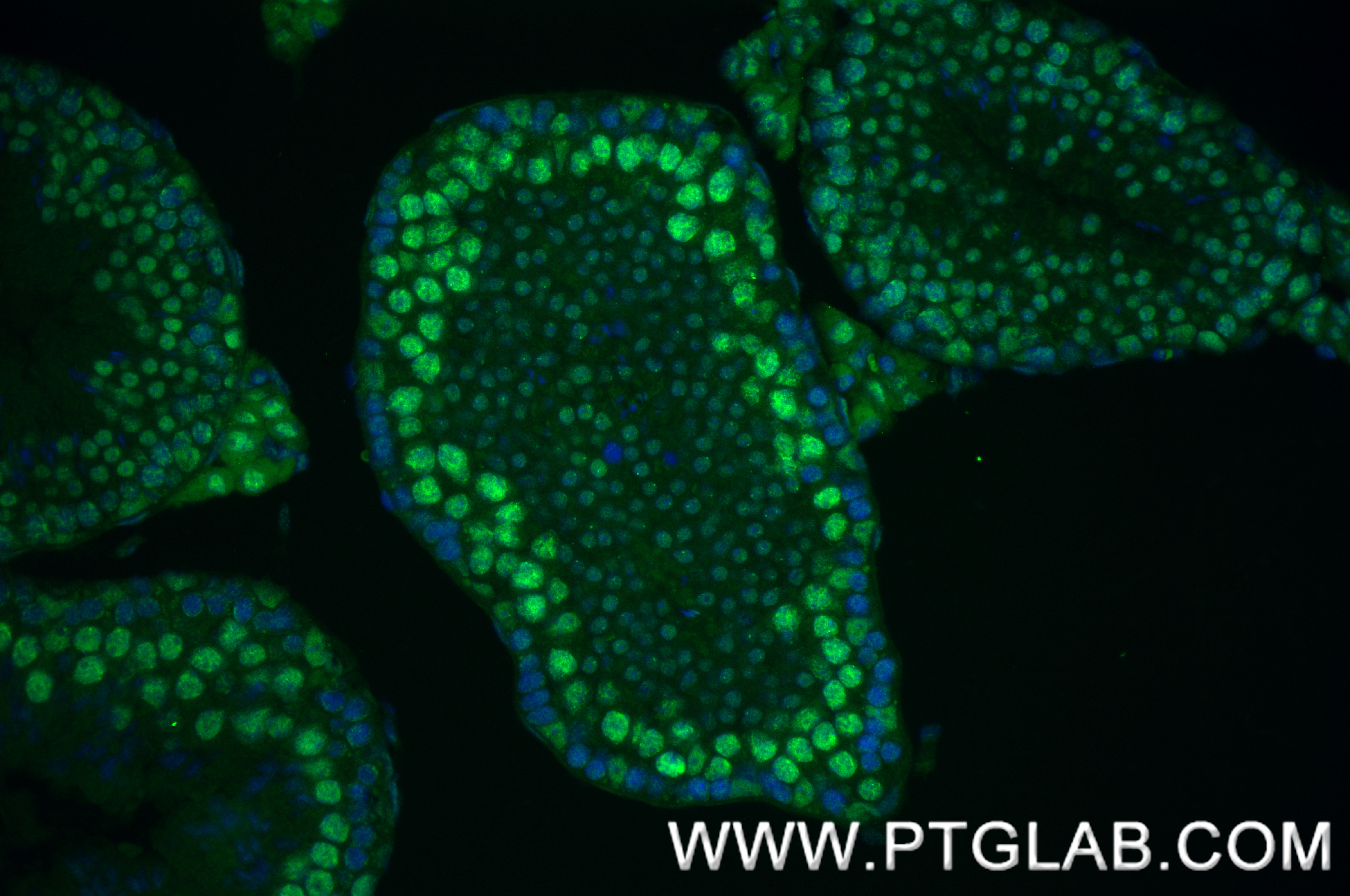 IF Staining of mouse testis using 80323-1-RR (same clone as 80323-1-PBS)