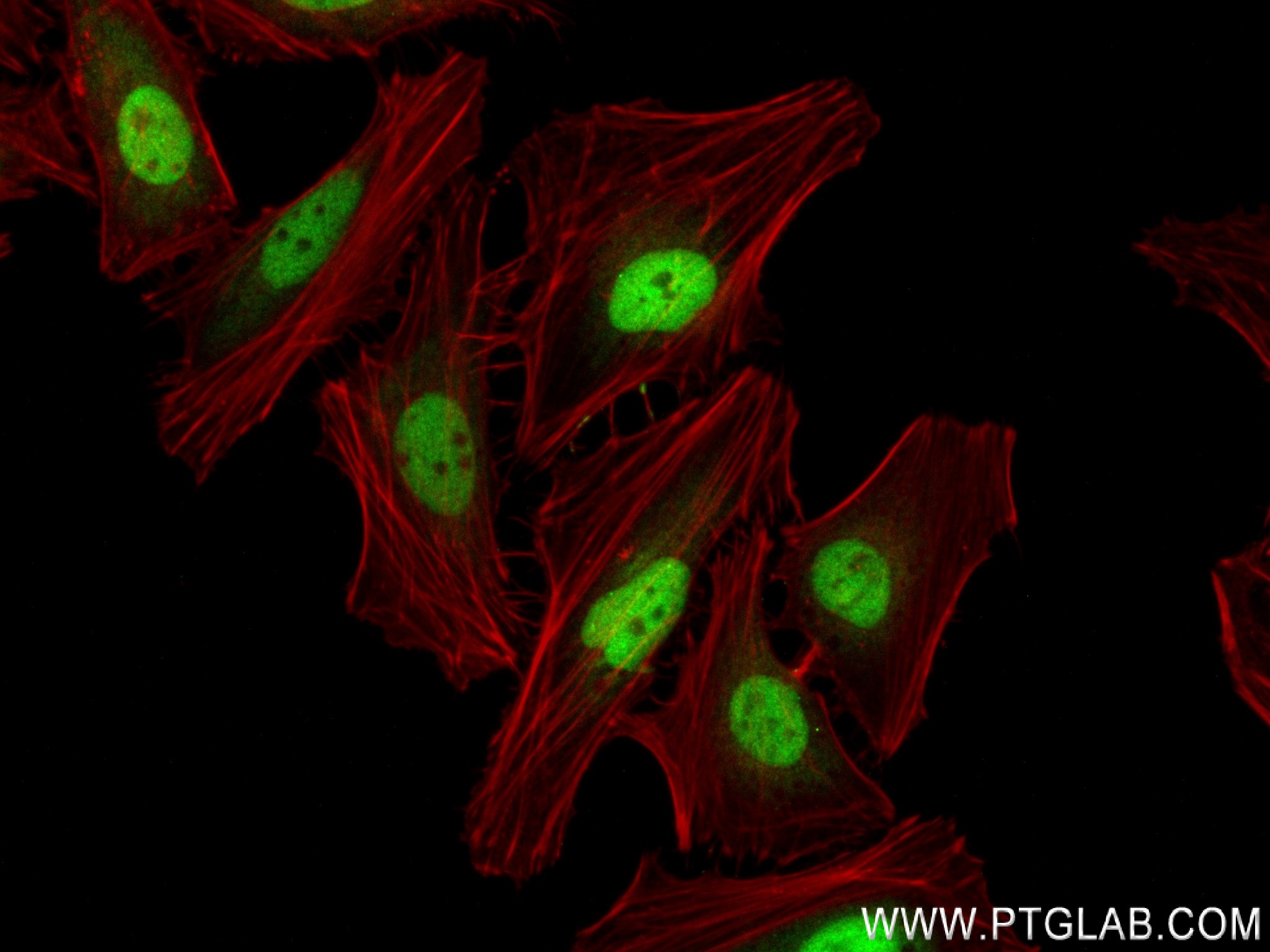 IF Staining of HeLa using 84209-5-RR (same clone as 84209-5-PBS)