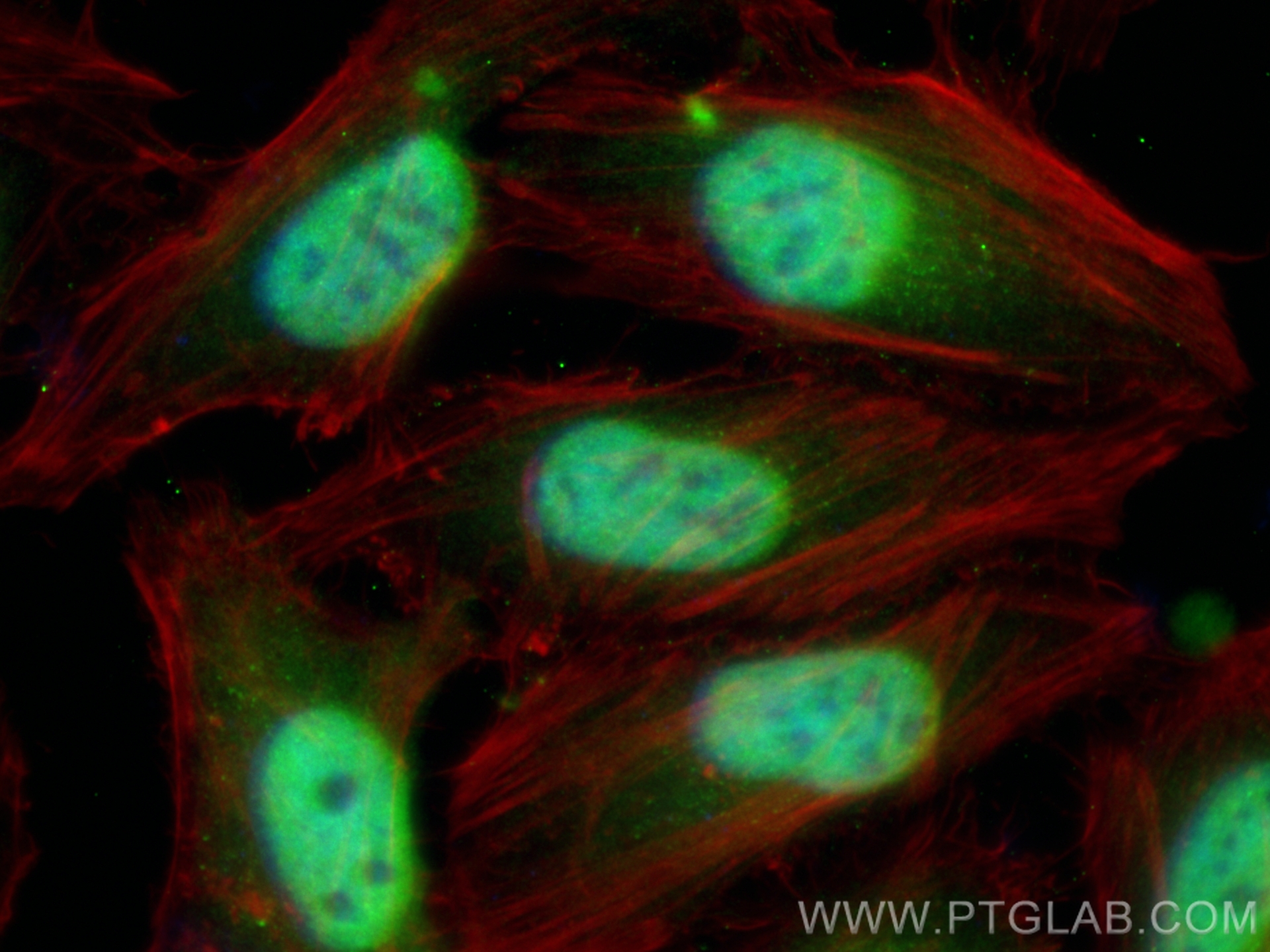 IF Staining of HeLa using CL488-84209-5