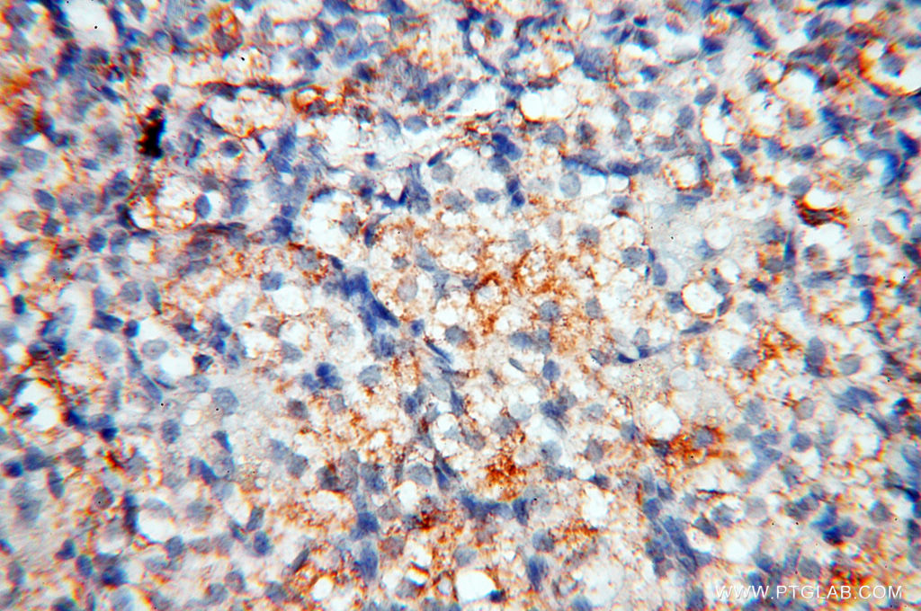 IHC staining of human ovary using 17661-1-AP