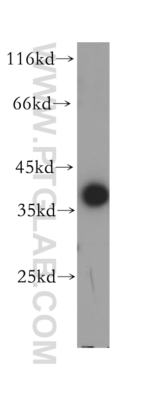 WB analysis of human kidney using 17661-1-AP