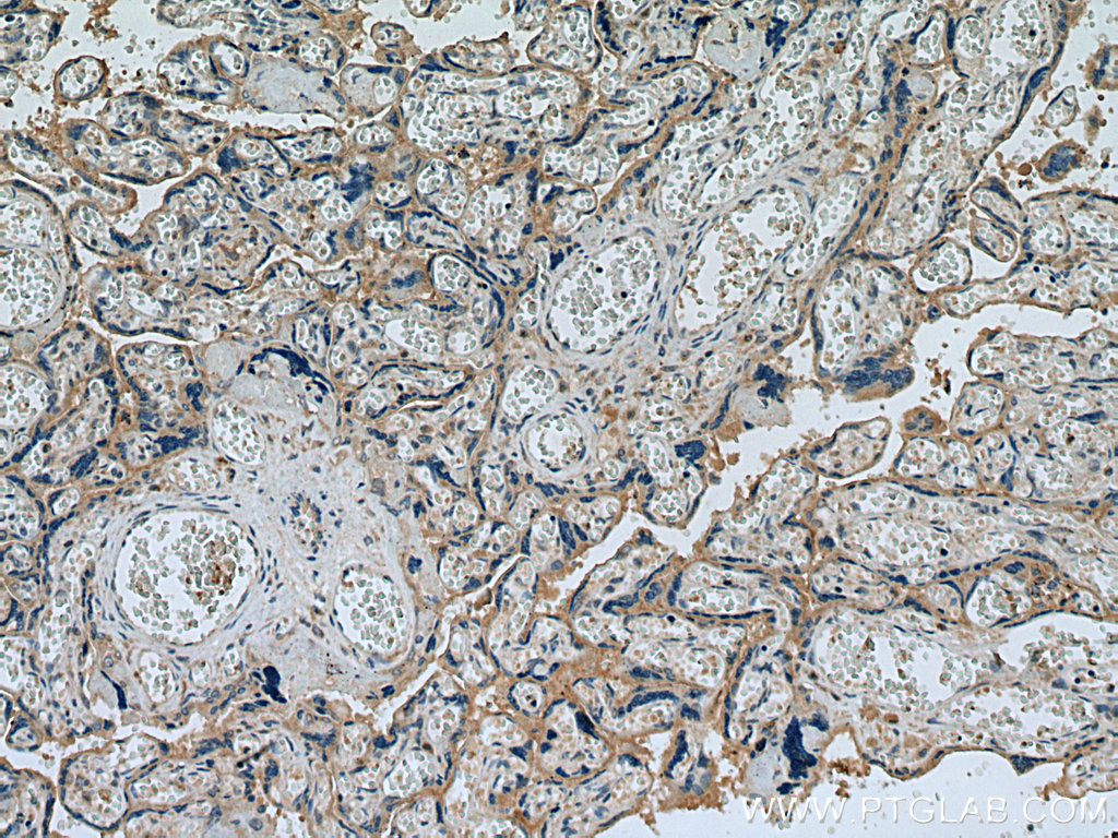 IHC staining of human placenta using 25498-1-AP