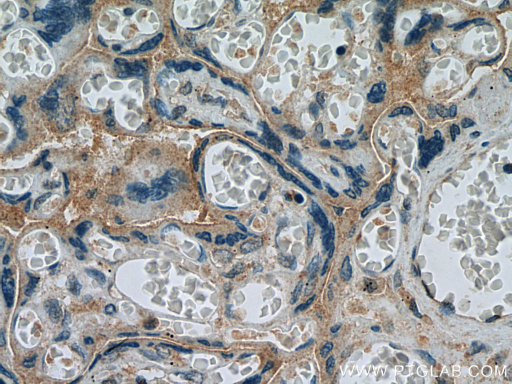 IHC staining of human placenta using 25498-1-AP