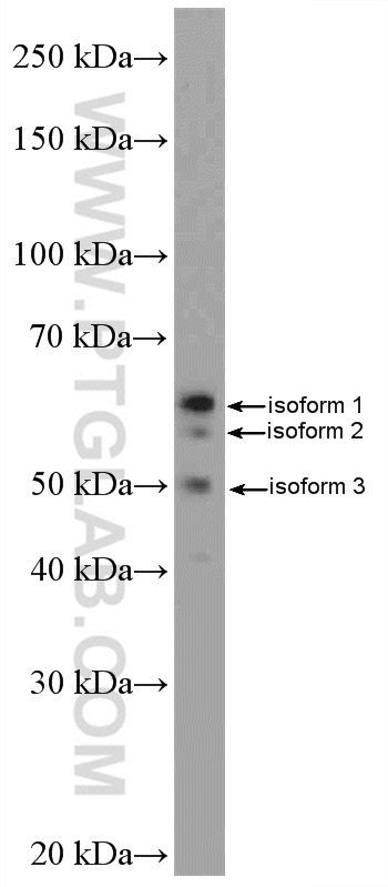 WB analysis of HepG2 using 25498-1-AP