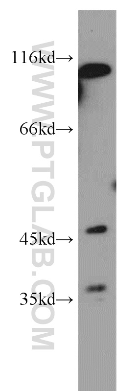 WB analysis of MCF-7 using 21037-1-AP