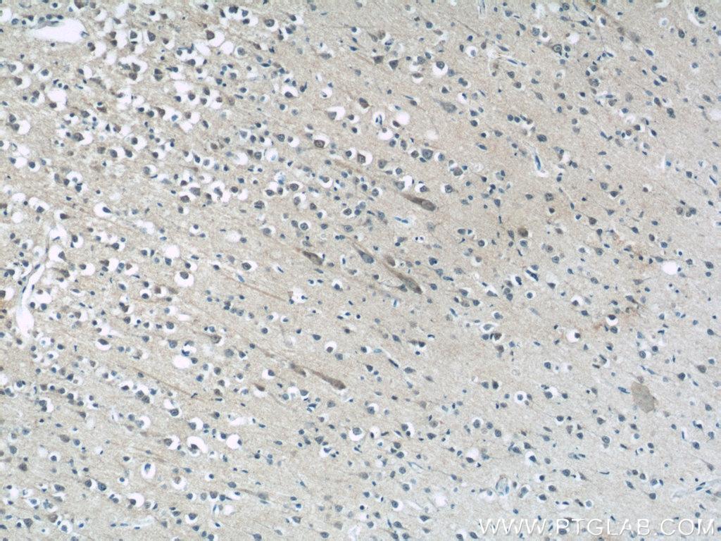 IHC staining of human brain using 24298-1-AP