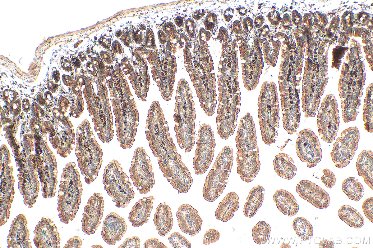 IHC staining of mouse small intestine using 25109-1-AP