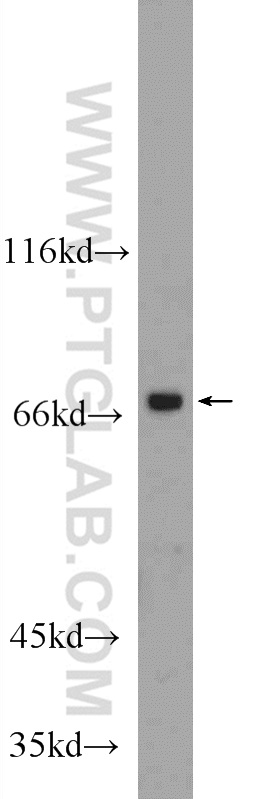 WB analysis of HeLa using 25109-1-AP