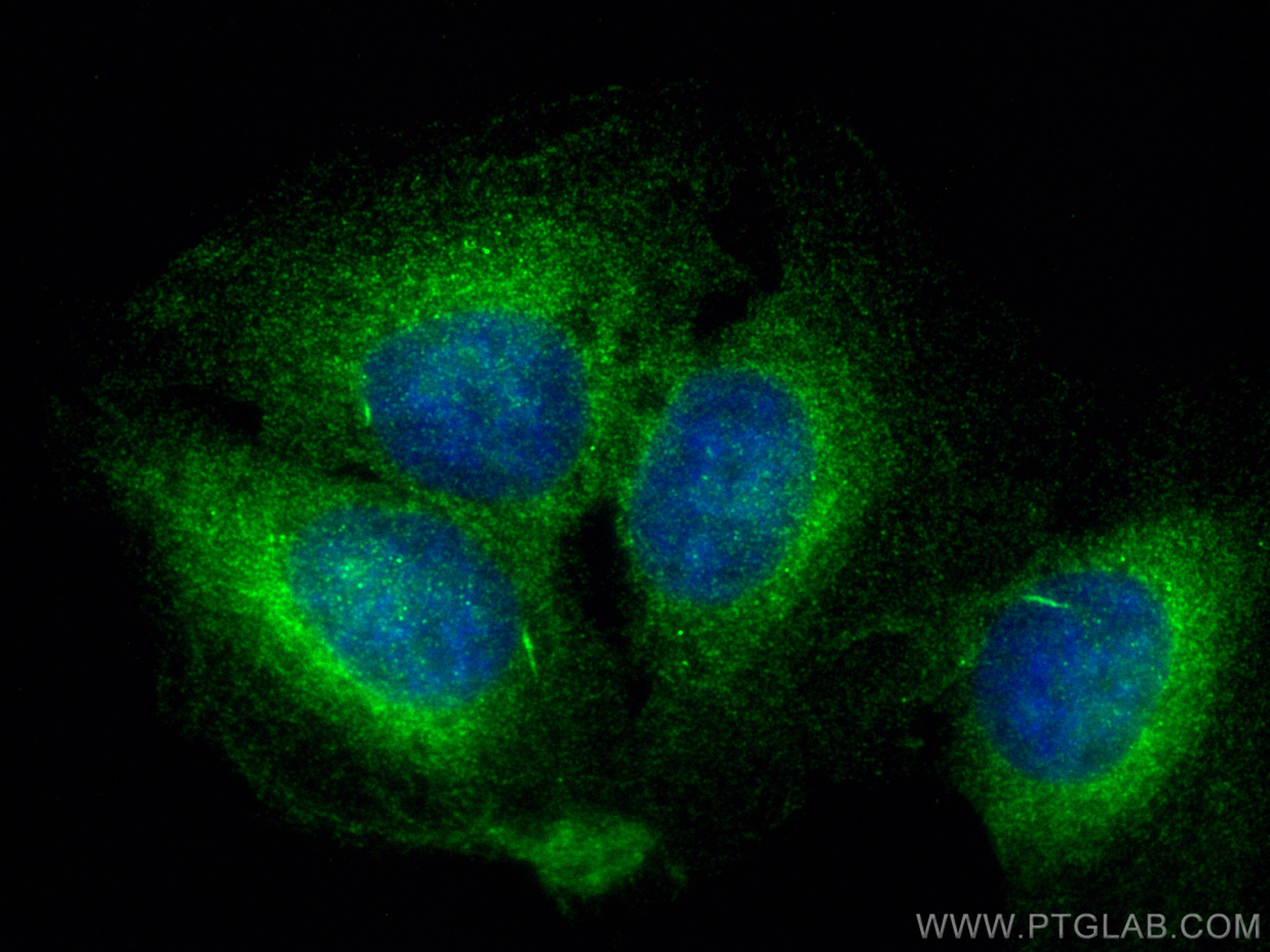 IF Staining of U2OS using 30718-1-AP (same clone as 30718-1-PBS)