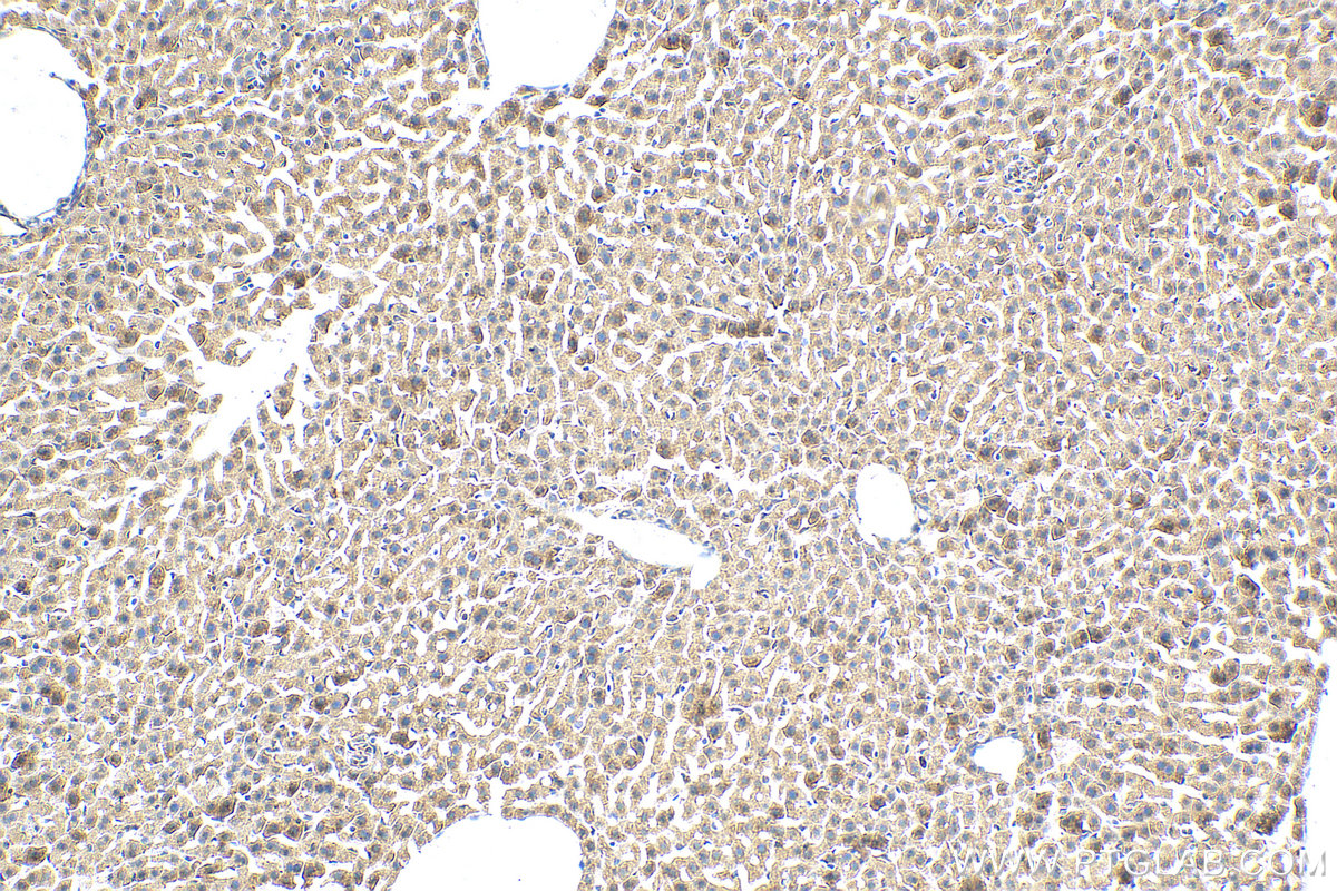 IHC staining of mouse liver using 30718-1-AP (same clone as 30718-1-PBS)