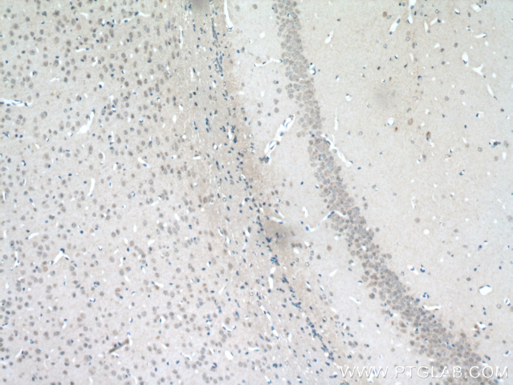 IHC staining of mouse brain using 16993-1-AP