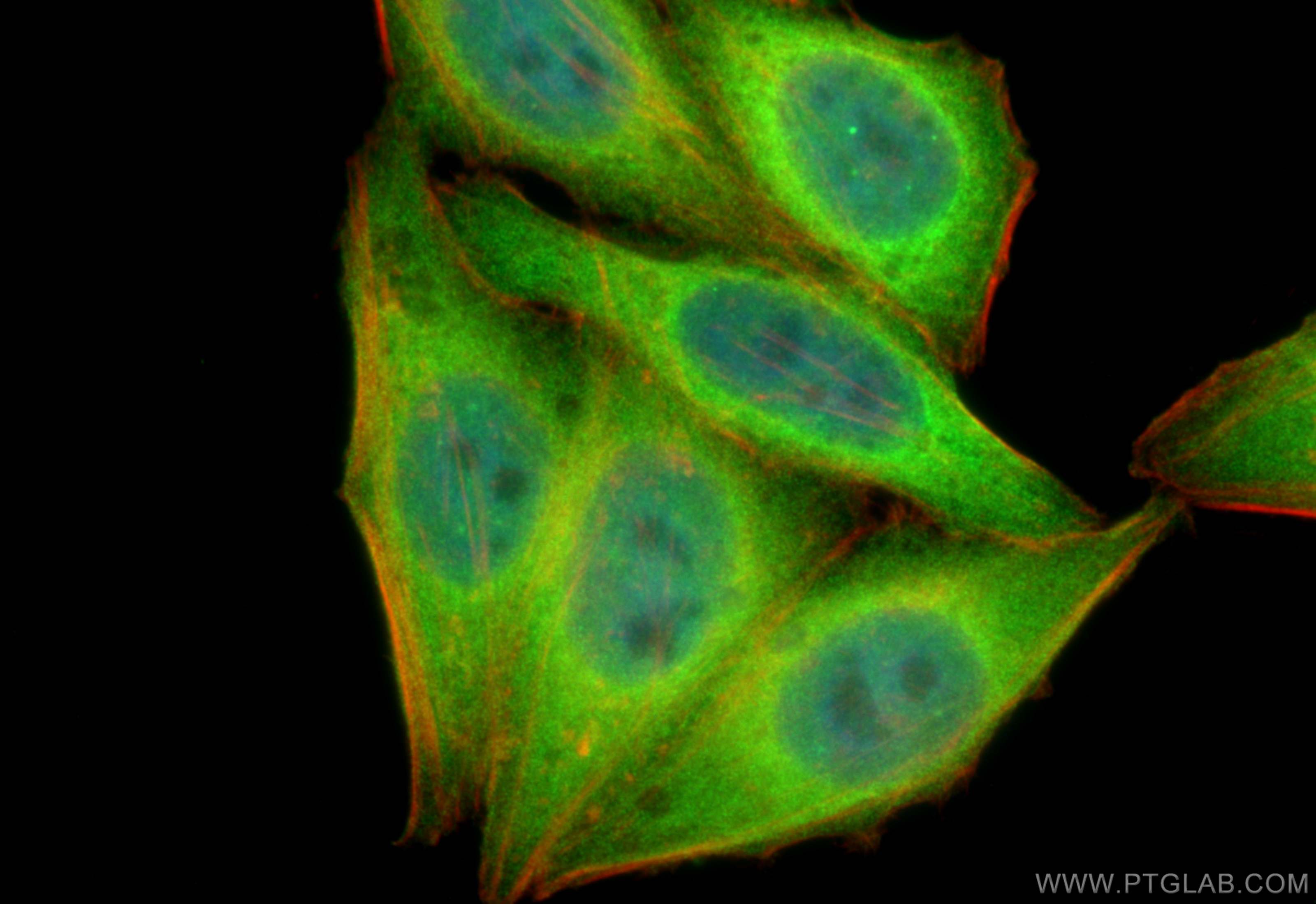 IF Staining of HepG2 using 14711-1-AP