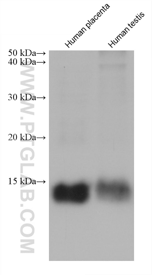 WB analysis using 60055-1-Ig (same clone as 60055-1-PBS)