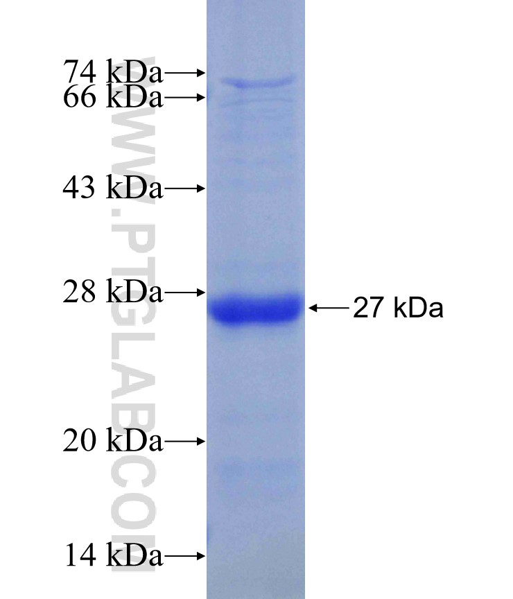 MIB2 fusion protein Ag29958 SDS-PAGE