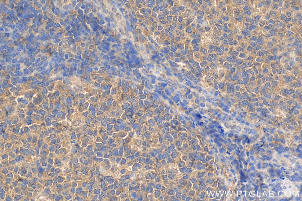 IHC staining of human tonsillitis using Biotin-65161