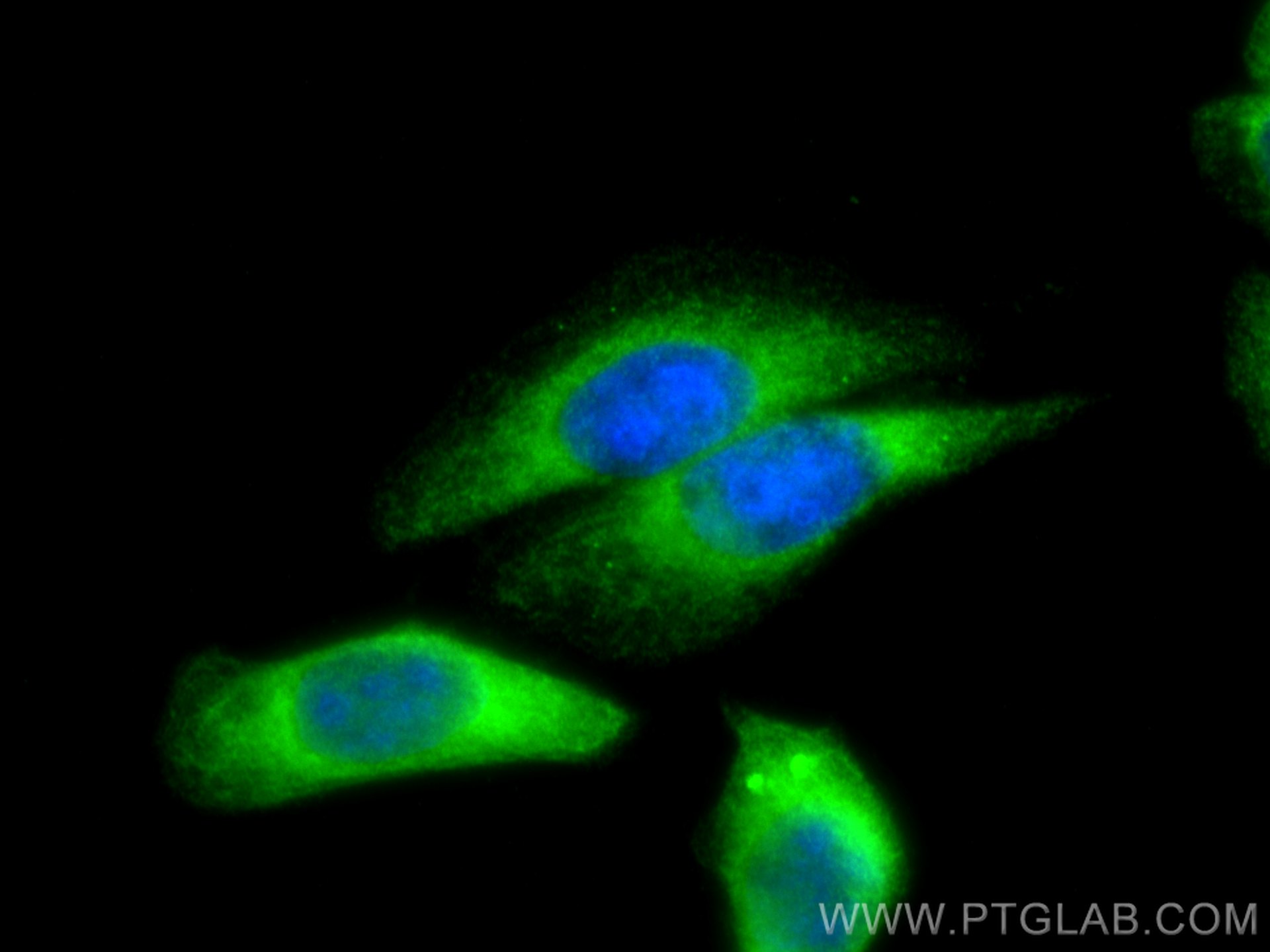 IF Staining of HepG2 using 13965-1-AP