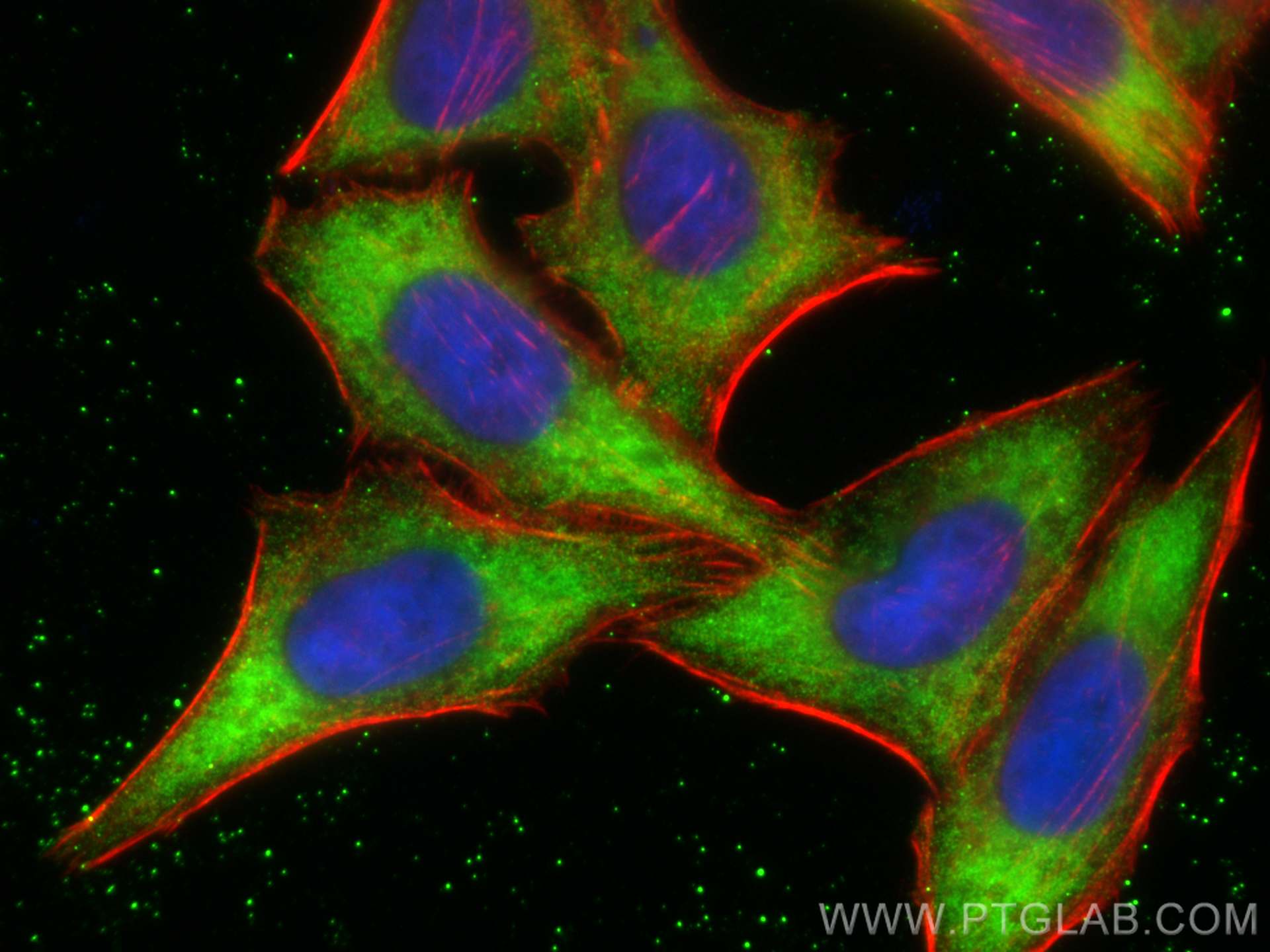 IF Staining of HepG2 using 13965-1-AP