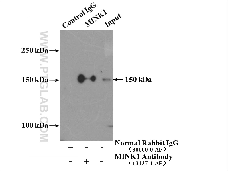 IP experiment of mouse brain using 13137-1-AP