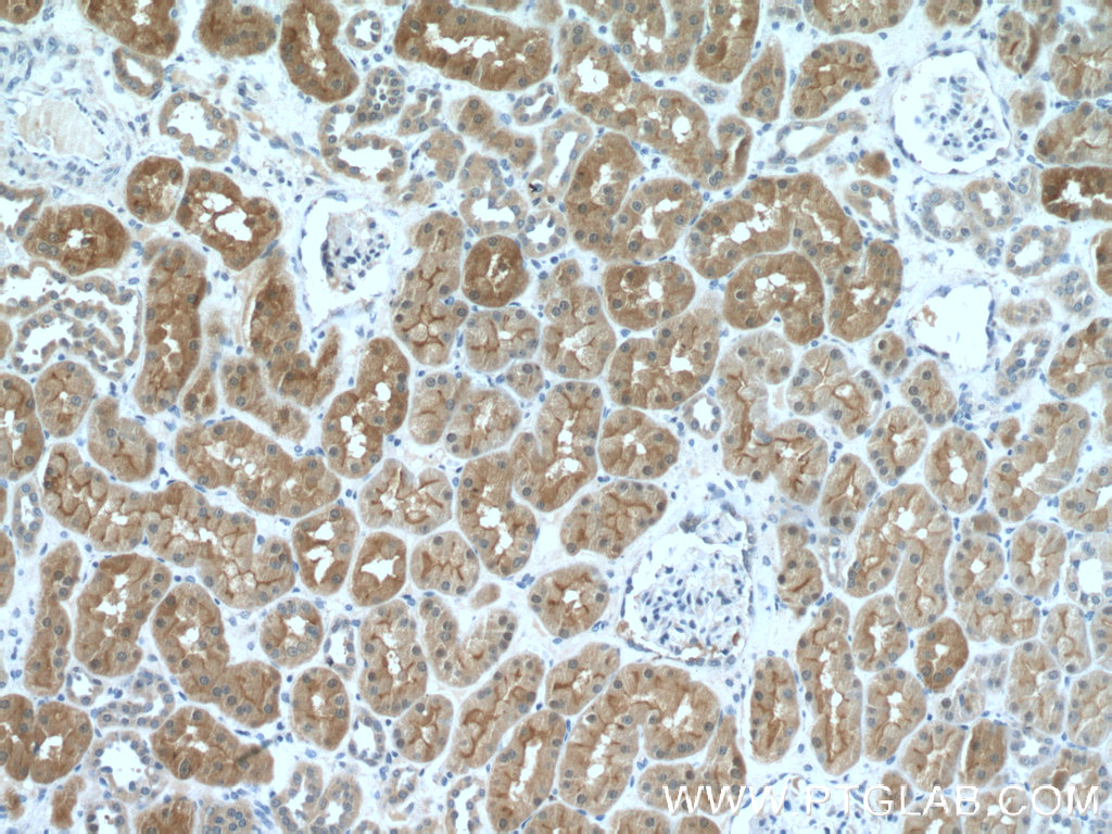 IHC staining of human kidney using 17623-1-AP