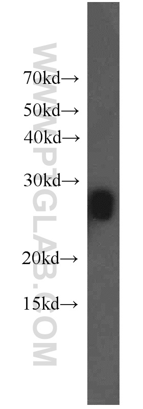 WB analysis of mouse eye using 17977-1-AP