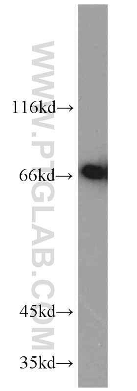 WB analysis of HepG2 using 11002-1-AP