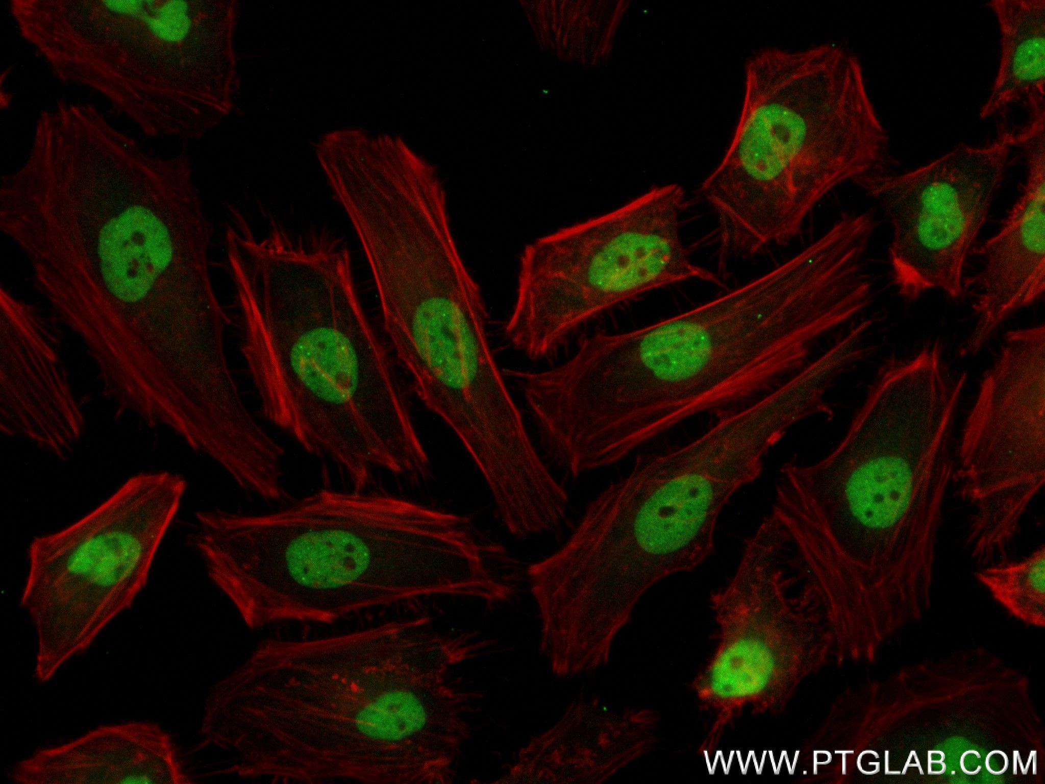 IF Staining of HeLa using 83803-2-RR (same clone as 83803-2-PBS)