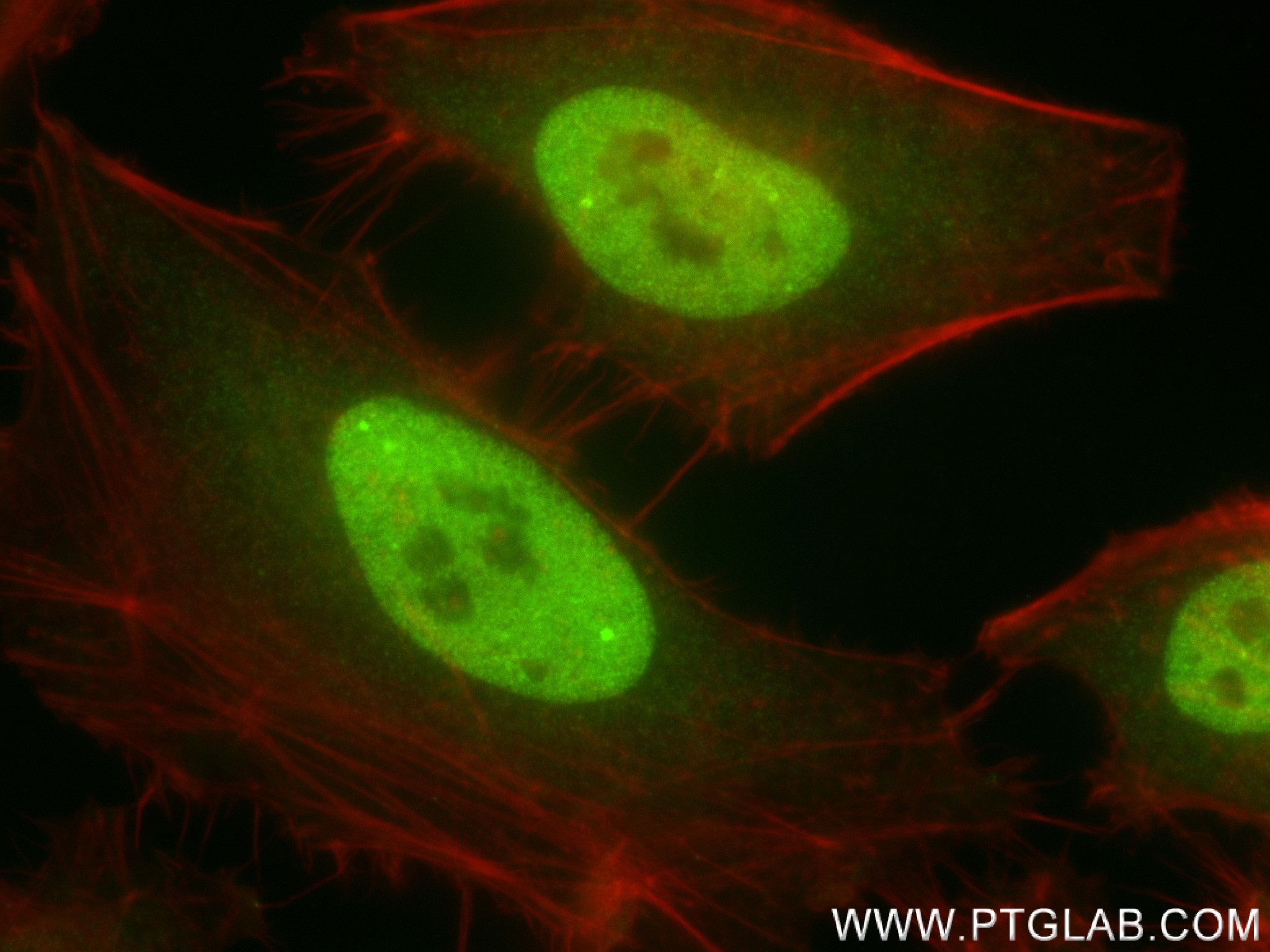 IF Staining of HeLa using 83803-2-RR (same clone as 83803-2-PBS)