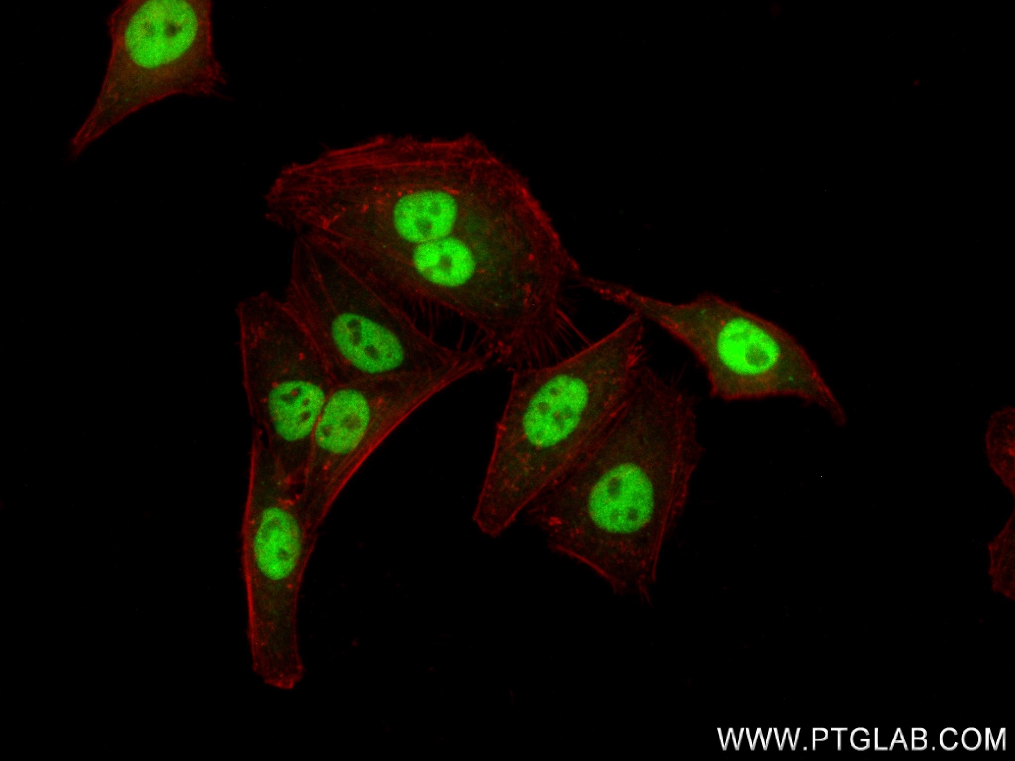 IF Staining of HepG2 using 83803-2-RR (same clone as 83803-2-PBS)