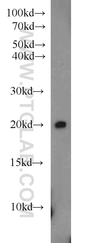 WB analysis of rat pancreas using 22772-1-AP