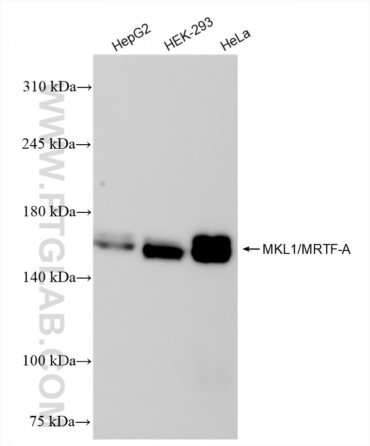 MKL1/MRTF-A