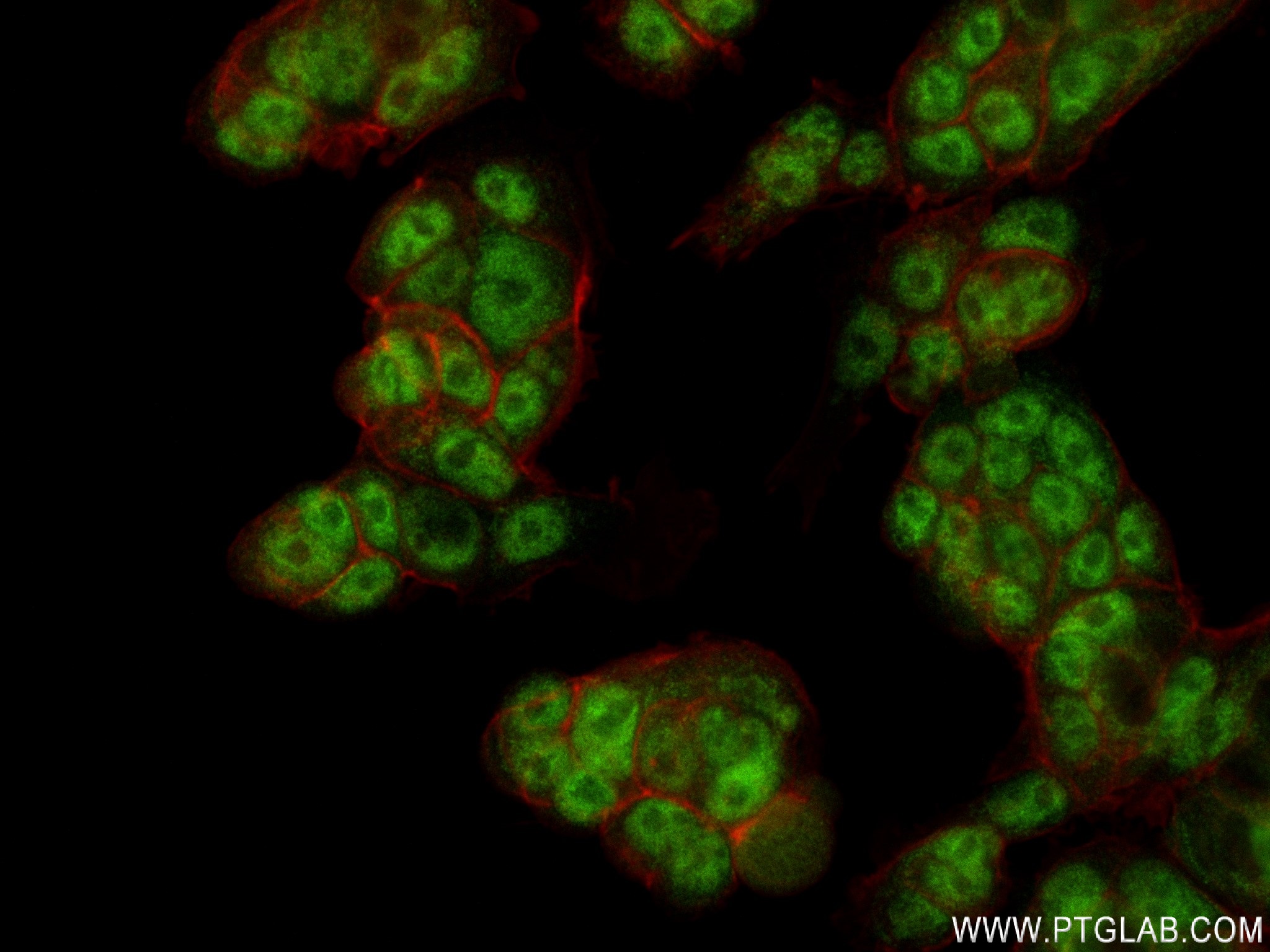 IF Staining of MCF-7 using 83235-1-RR (same clone as 83235-1-PBS)