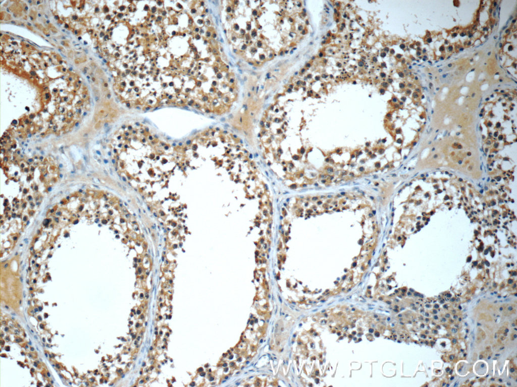 IHC staining of human testis using 13186-1-AP