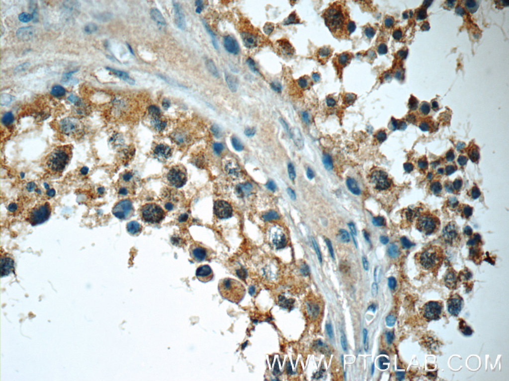 IHC staining of human testis using 13186-1-AP