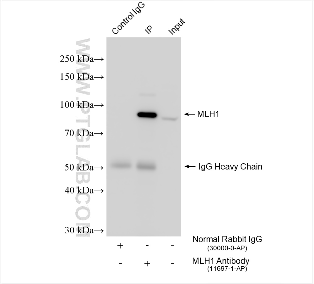 IP experiment of HeLa using 11697-1-AP