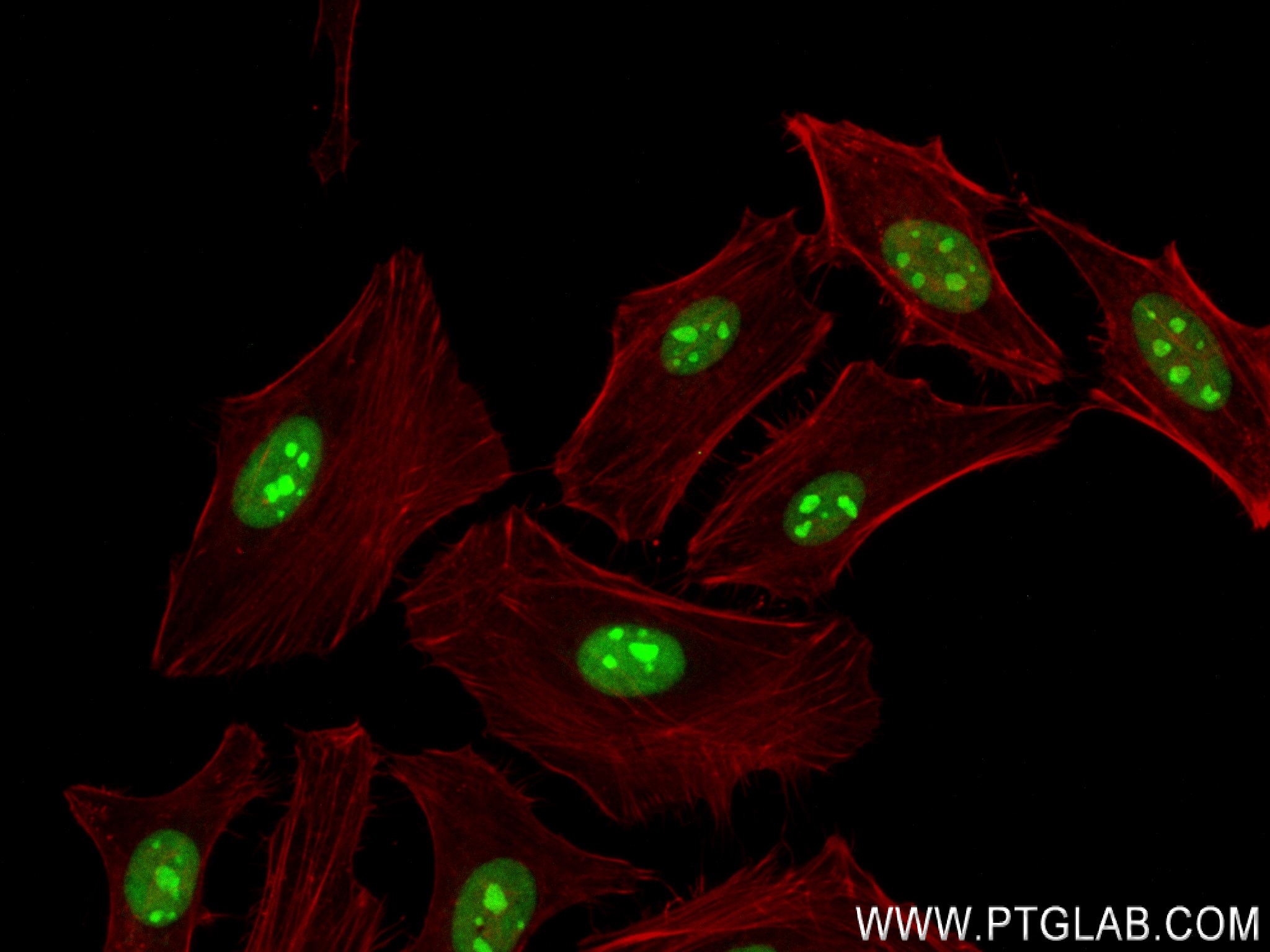 IF Staining of HeLa using 84208-2-RR (same clone as 84208-2-PBS)