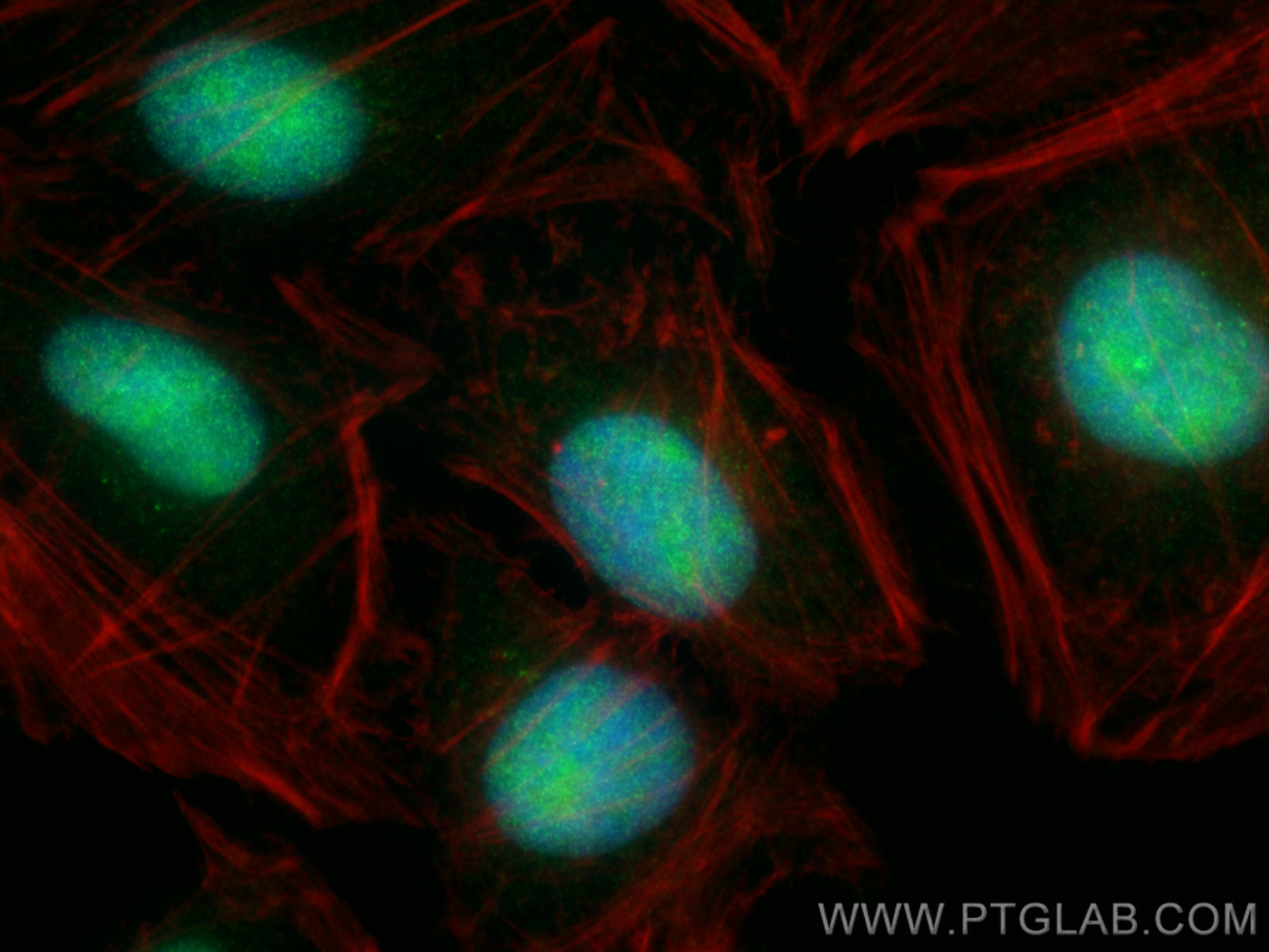 IF Staining of HeLa using 84208-2-RR