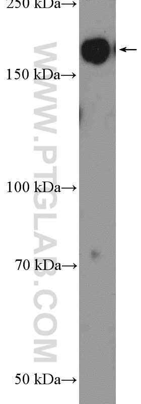 WB analysis of HepG2 using 25298-1-AP