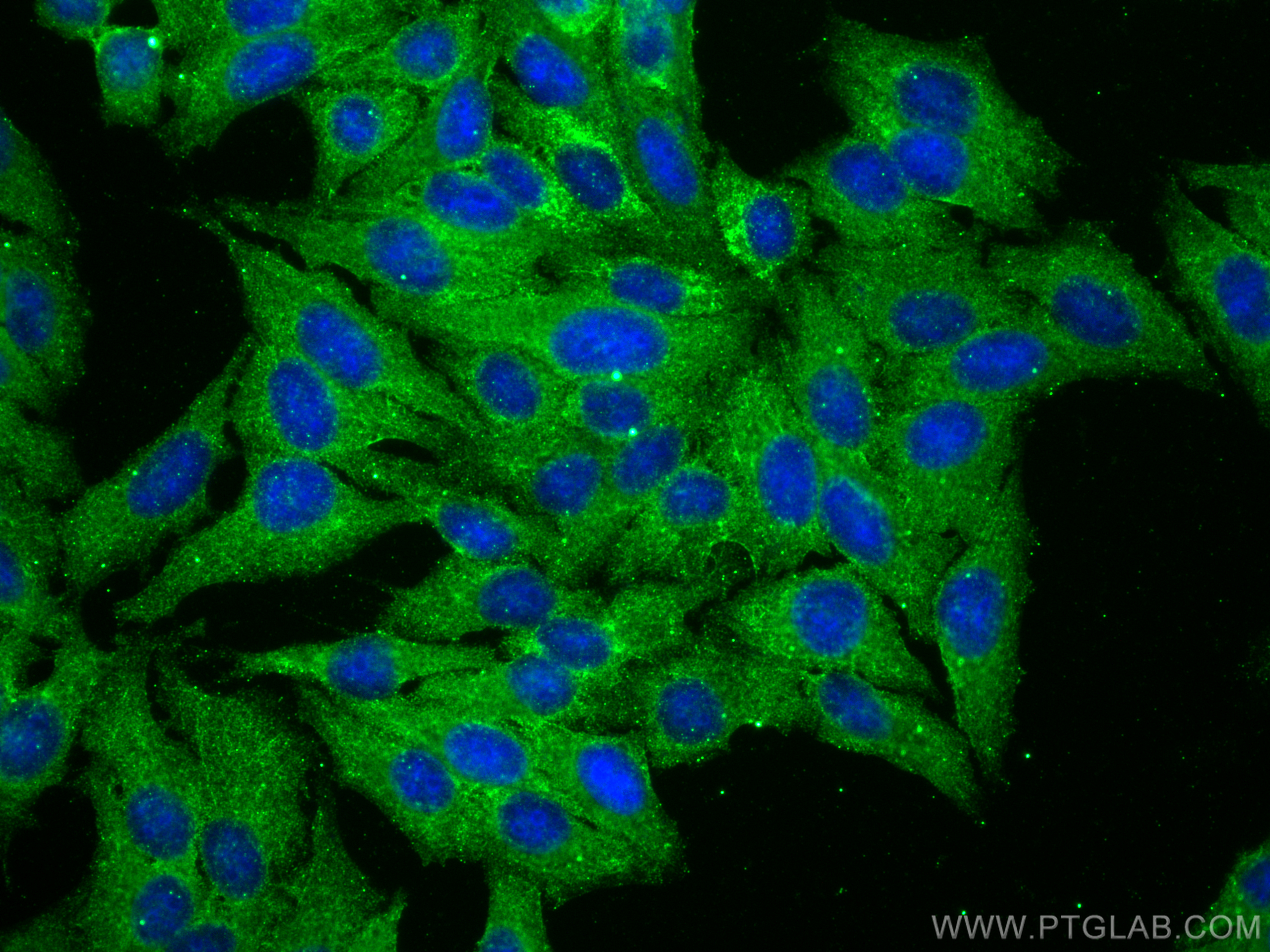 IF Staining of HepG2 using 66675-1-Ig