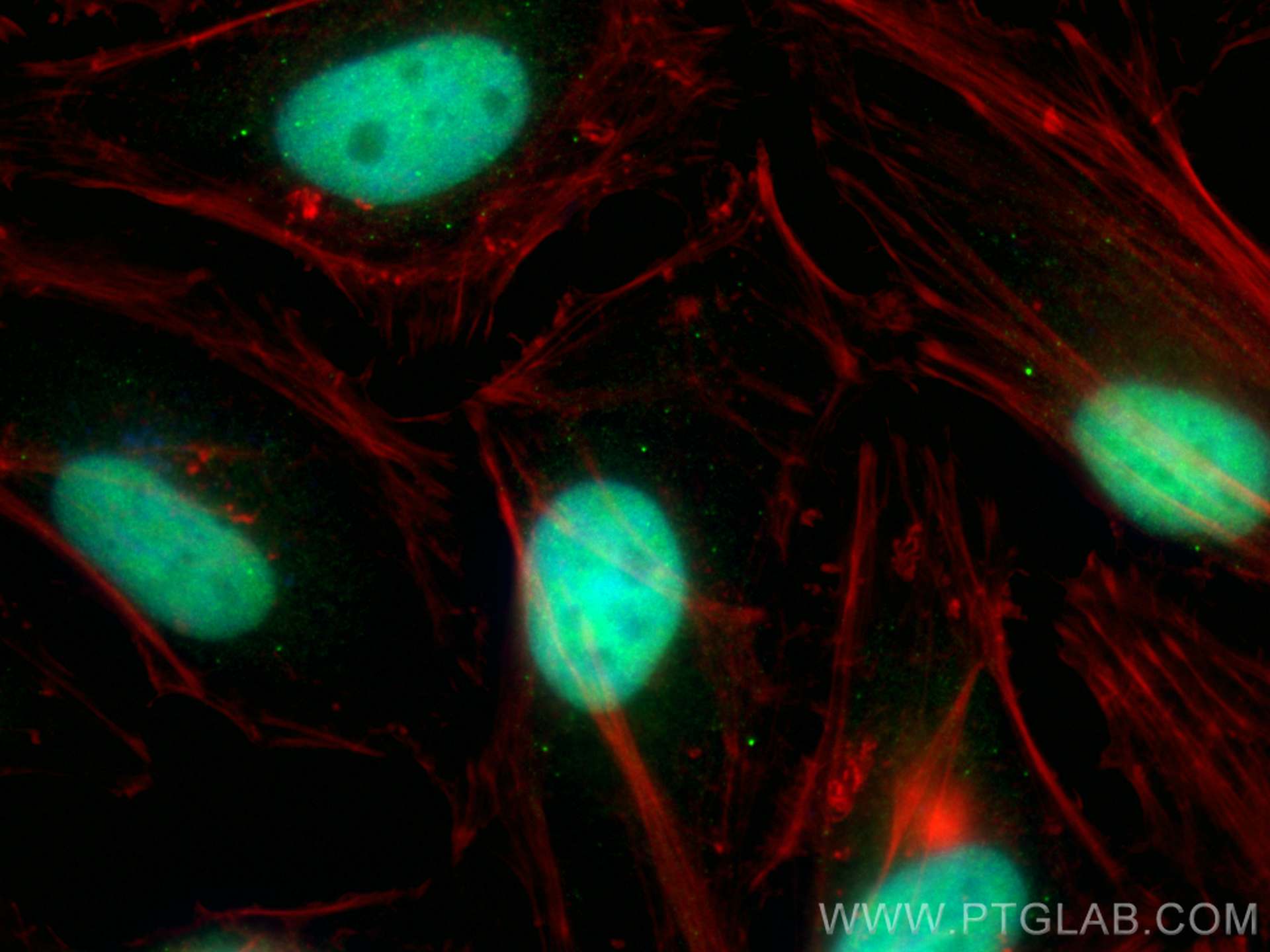 IF Staining of HeLa using 31029-1-AP (same clone as 31029-1-PBS)