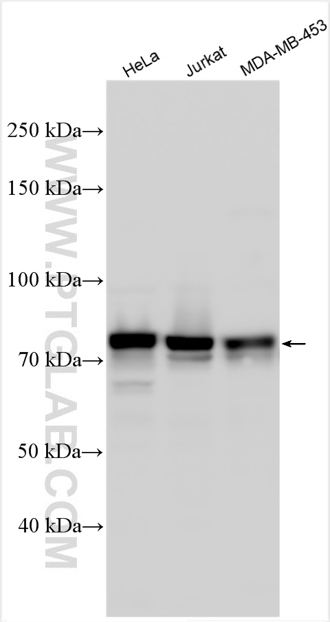 WB analysis using 31029-1-AP