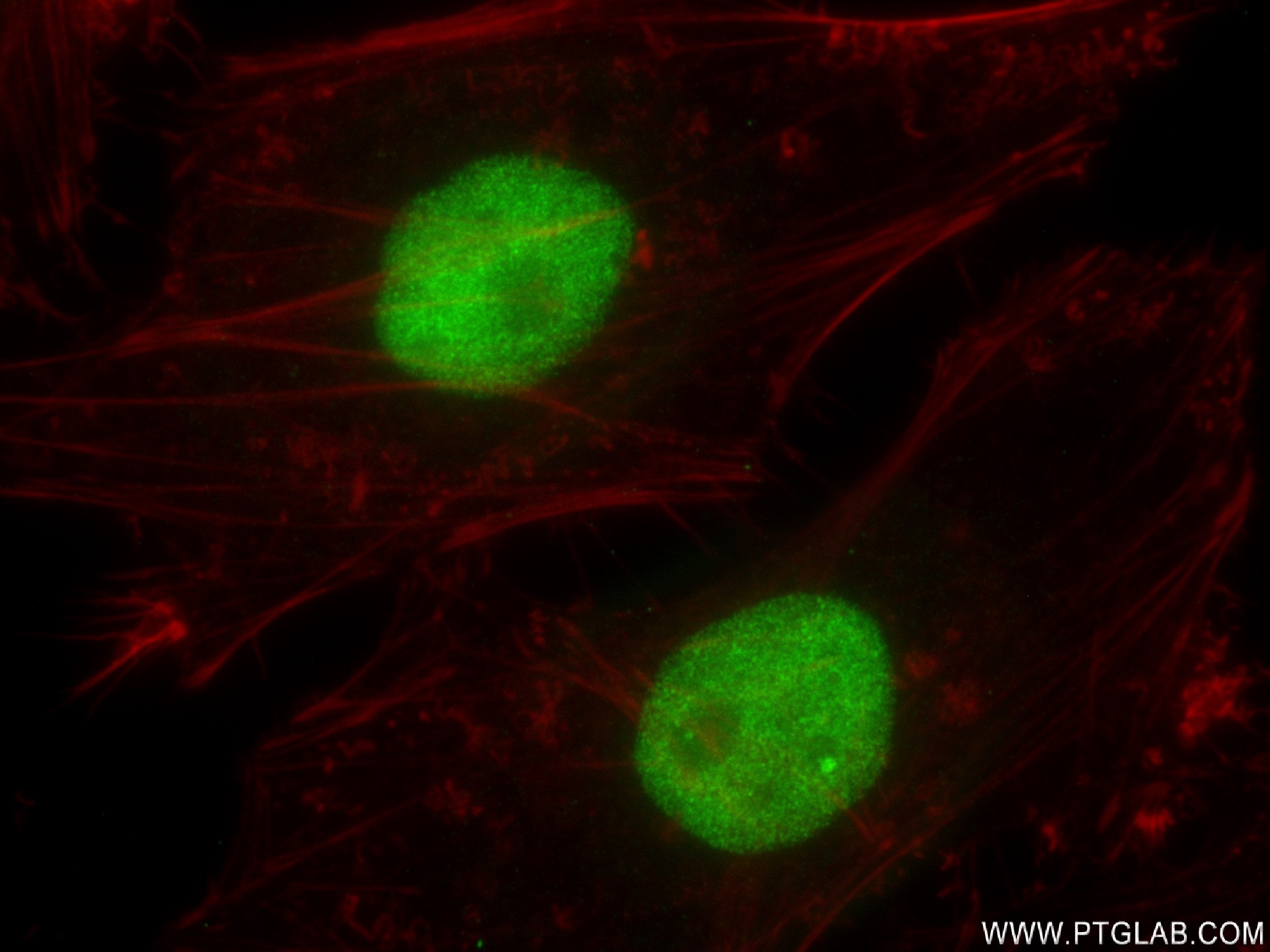 IF Staining of HeLa using 83242-3-RR (same clone as 83242-3-PBS)