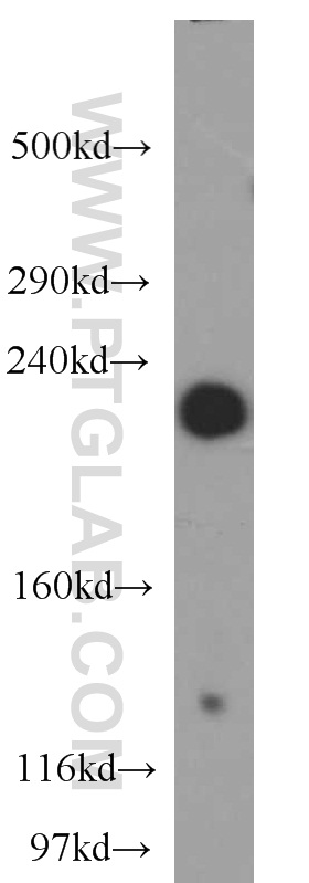 WB analysis of mouse kidney using 55102-1-AP