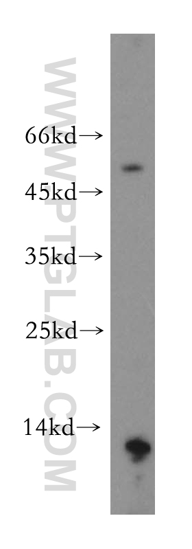 WB analysis of human stomach using 18824-1-AP