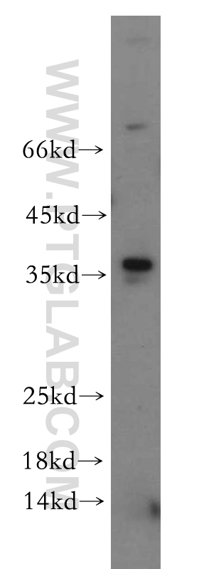 WB analysis of mouse thymus using 12042-1-AP