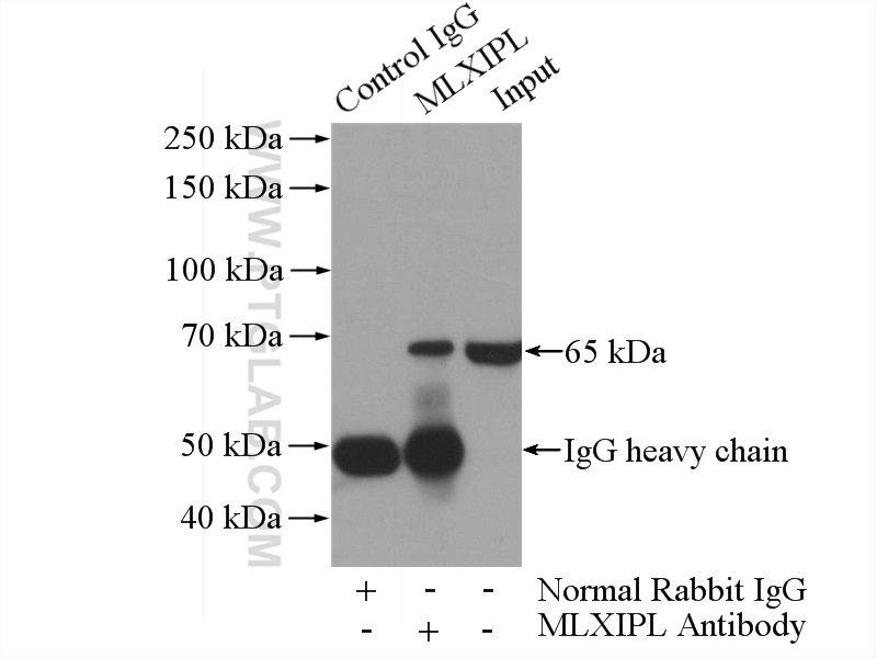 IP experiment of HepG2 using 13256-1-AP