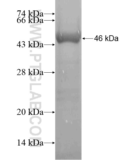 MLYCD fusion protein Ag18825 SDS-PAGE