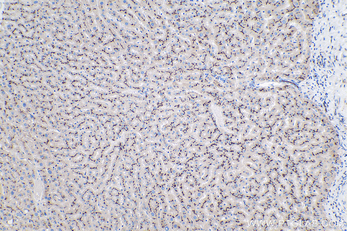 IHC staining of human liver using 60034-3-Ig