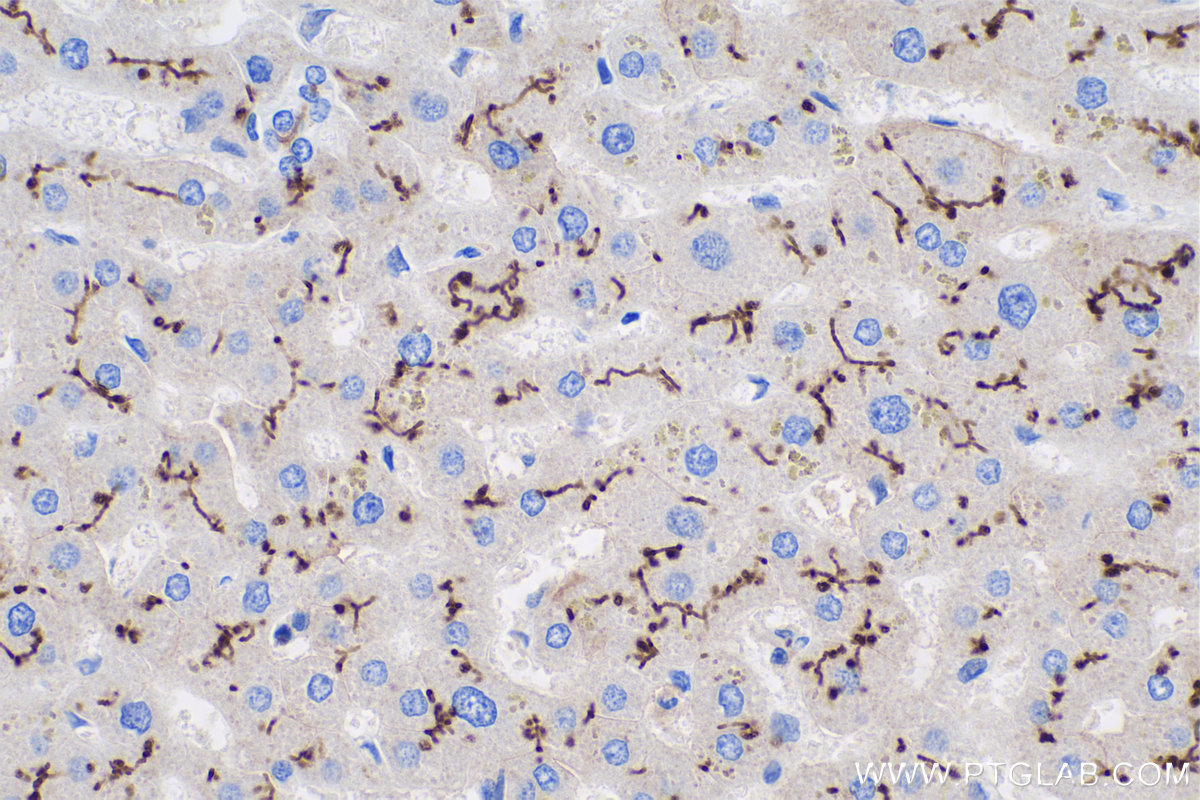 IHC staining of human liver using 60034-3-Ig